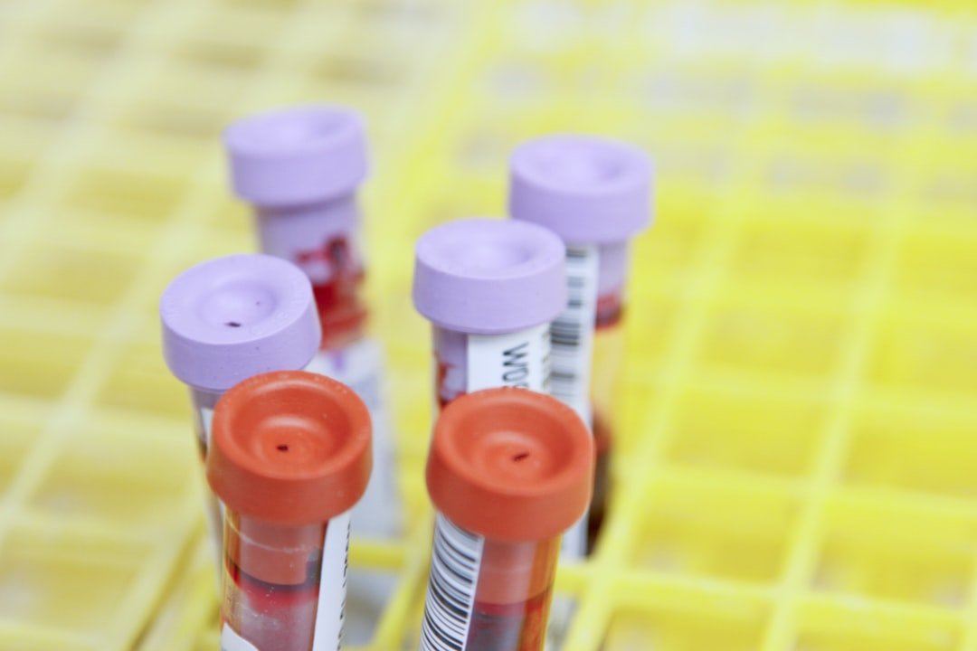 blood, blood draw, blood analysis